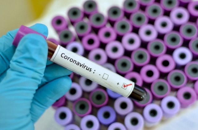 Bahia confirma décimo caso do novo Coronavírus