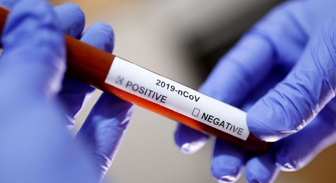 4º caso: Ministério da Saúde confirma coronavírus em adolescente sem sintomas