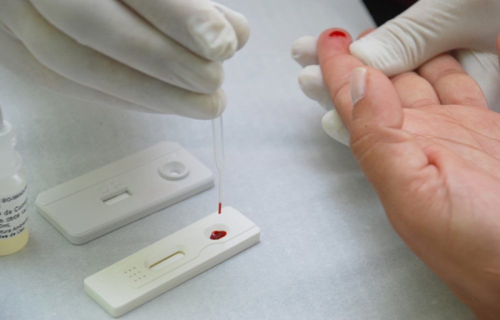 Ilhéus recebe 760 testes rápidos para diagnóstico da Covid-19