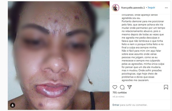 “Ele sempre pedia desculpas e falava que não lembrava”, conta mulher agredida a socos em Ilhéus; homem está foragido