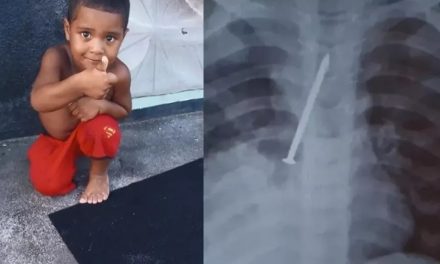 Menino morre após passar 1 ano com prego no pulmão na Bahia; família acusa hospital de negligência