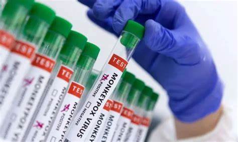 Bahia tem 30 casos confirmados de varíola dos macacos