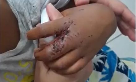 Almadina: suspeito de maus-tratos contra filho de 4 anos confessa que agredia a criança após beber