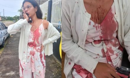 Suspeita de cortar rosto de jovem de Itabuna durante viagem de ônibus é presa em São Paulo